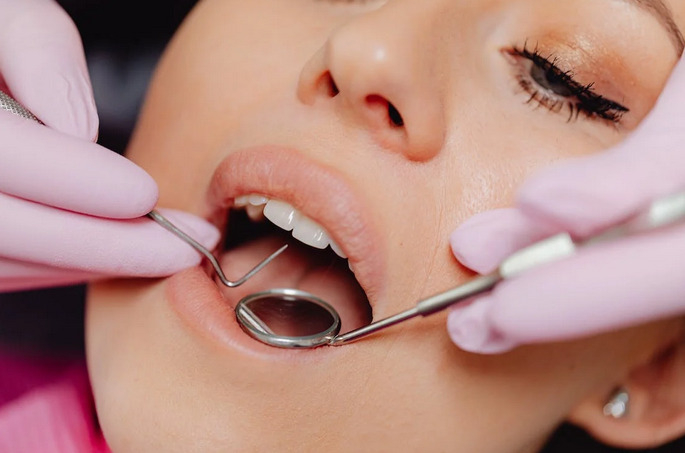 Pros of Getting Professional Teeth Cleaning