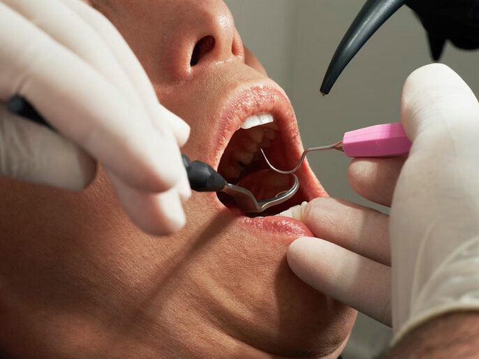 How Emergency Dentists Provide Timely Treatment and Prevent Further Damage